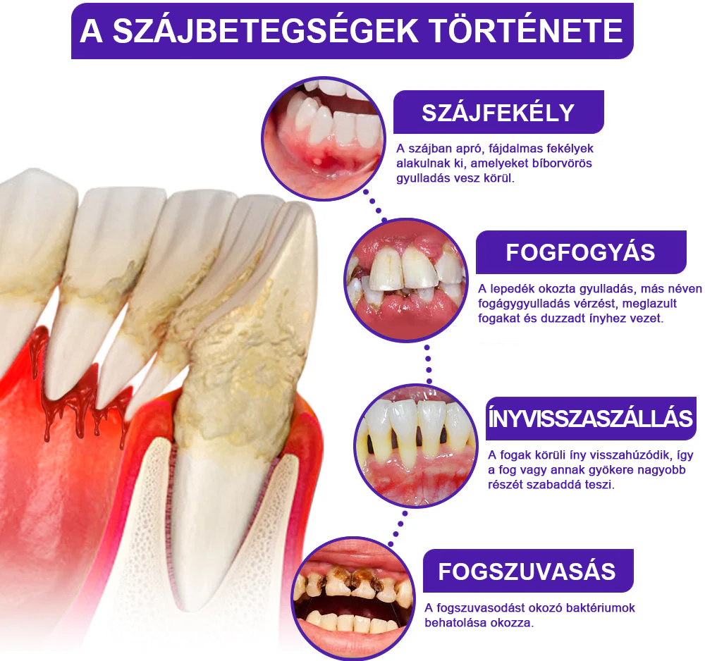 🌟Rolimey® VioCore zobna pasta s čebeljim strupom-SI