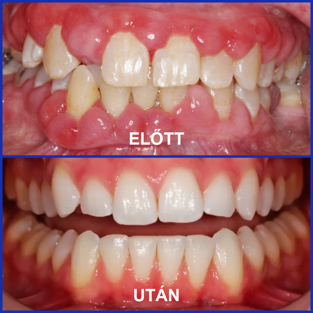 🌟Rolimey® VioCore zobna pasta s čebeljim strupom-SI