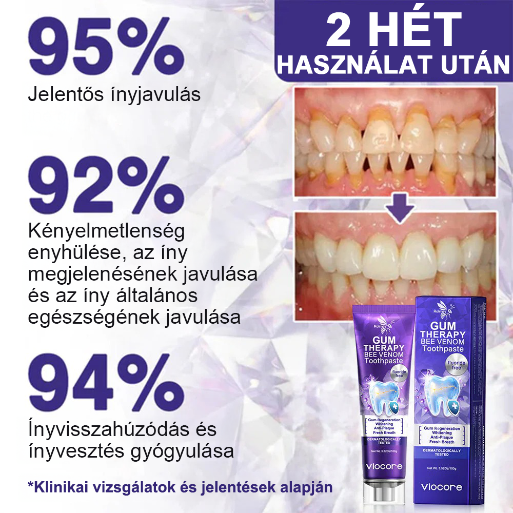 🌟Rolimey® VioCore zobna pasta s čebeljim strupom-SI