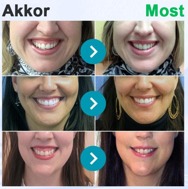 🌟Rolimey® VioCore zobna pasta s čebeljim strupom-SI