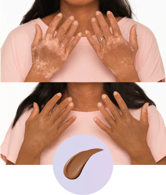 💜Zadnji dan – kupite 1, dobite 1 gratis!💜✨Body Perfector – vodoodporna, lahka in brezhibna ličila za telo-SI