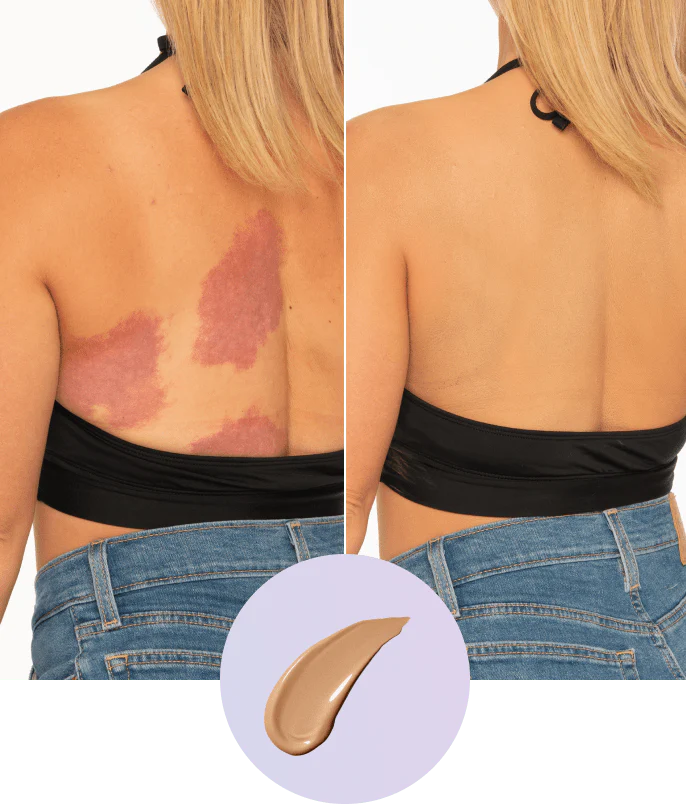 💜Zadnji dan – kupite 1, dobite 1 gratis!💜✨Body Perfector – vodoodporna, lahka in brezhibna ličila za telo-SI