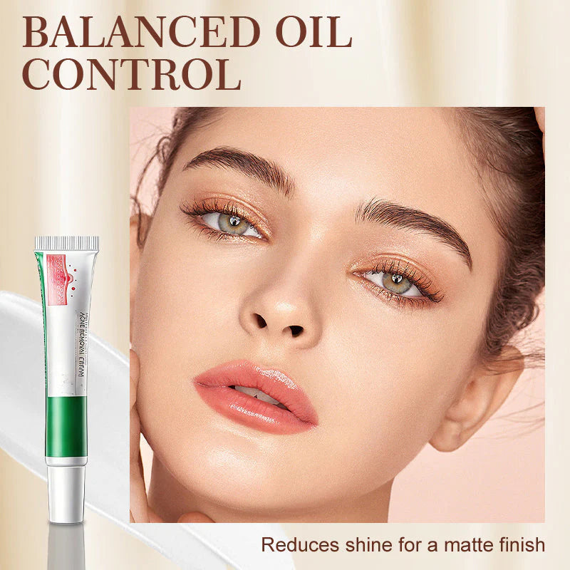 Crema calmante multifuncional para el tratamiento del acné-ES