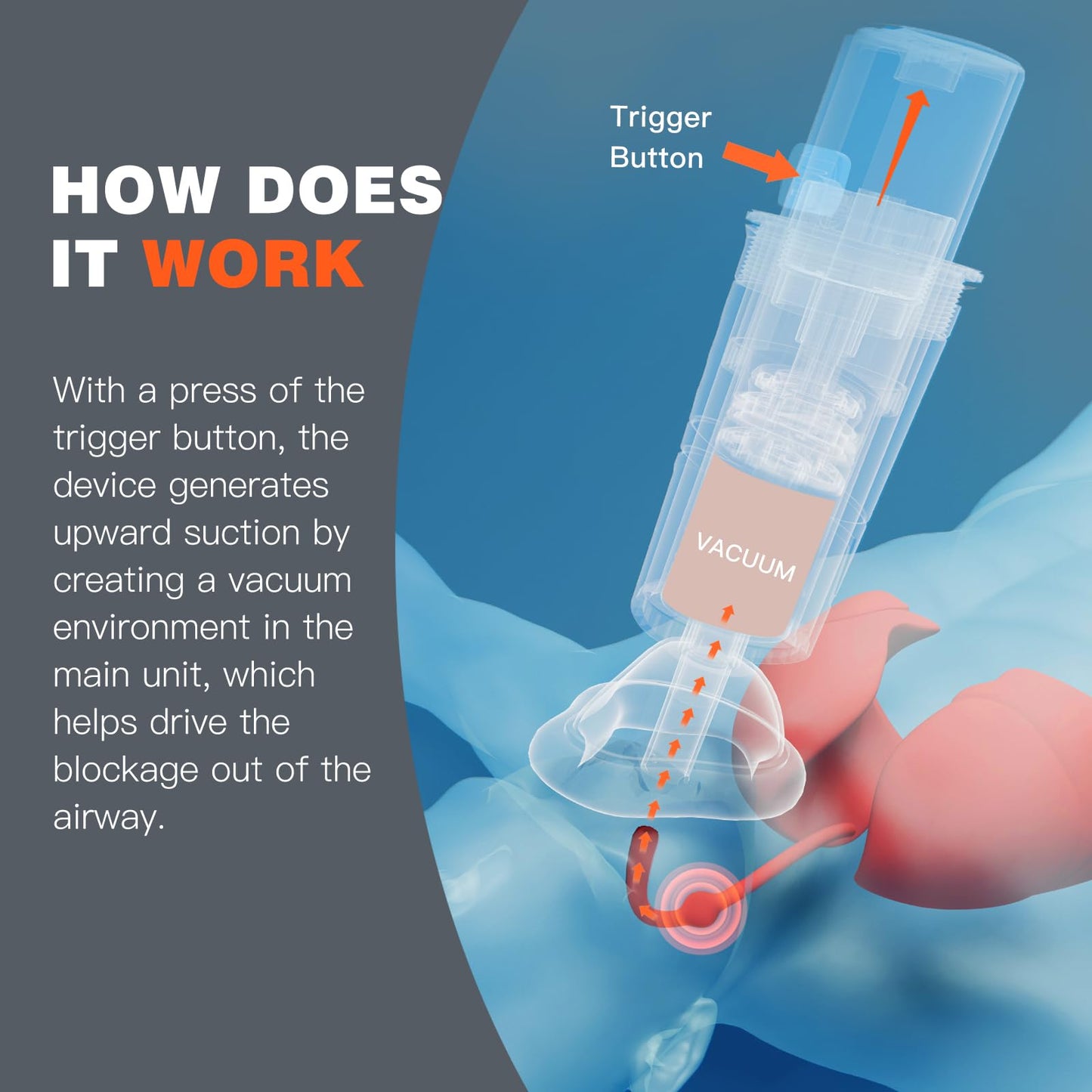 AYUDA PARA RESCATAR EN CASO DE ASFIXIA-ES