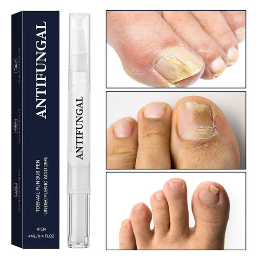 🔥Στυλό για θεραπεία μύκητα νυχιών ποδιών (για κατεστραμμένα νύχια)-GR